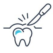 Oral Surgery Oral Surgery