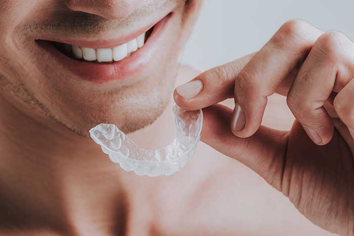Mouth-Guard Mouth-Guard