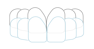 custom-tooth-tray-cen custom-tooth-tray-cen